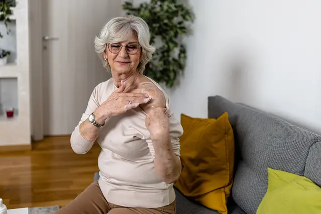 An older woman putting on a hormone cream on her shoulder