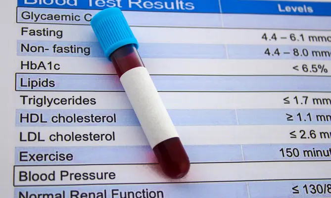 Blood cholesterol test sample with results