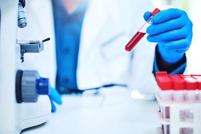 Scientist holding a test tube with red liquid near a microscope.