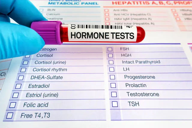 Blood sample labeled "Hormone Tests" over a list of hormone checkboxes.